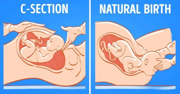 Myths About Normal Birth